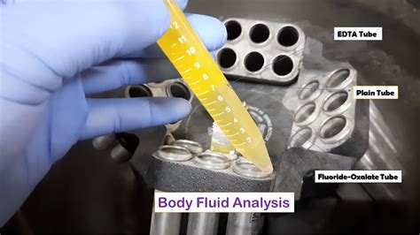 body fluid lab analyzer price|Body Fluid Analysis: Introduction, List of Tests, Unit .